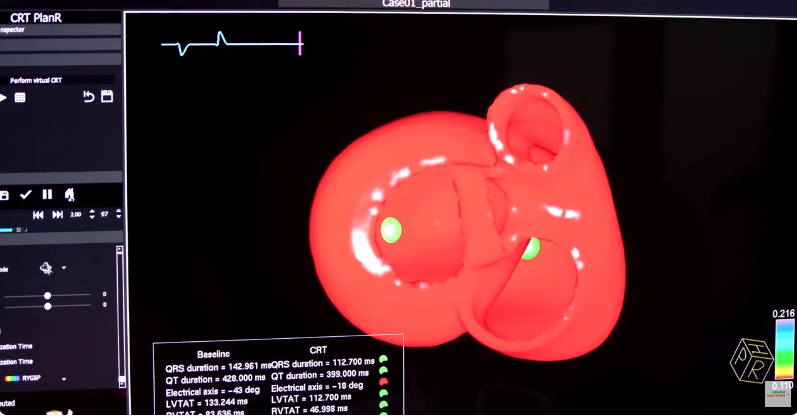 Digital twin of a patient: A look into the future